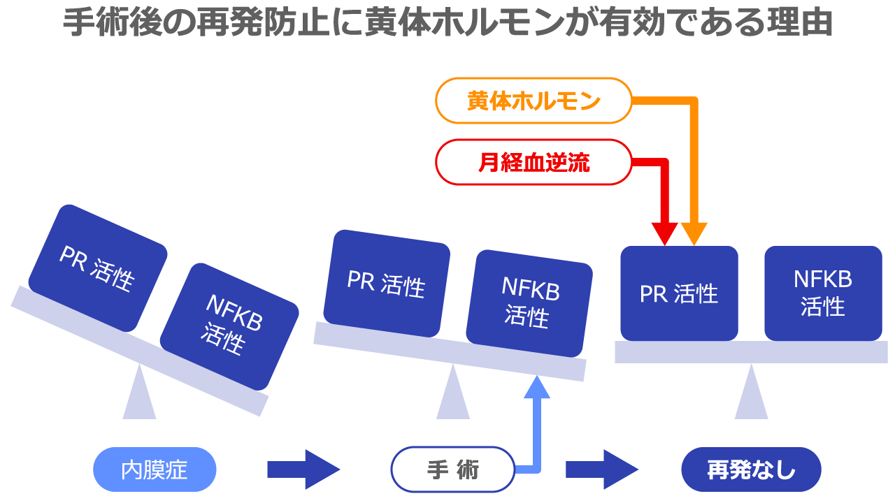 手術後の再発防止に黄体ホルモンが有効である理由